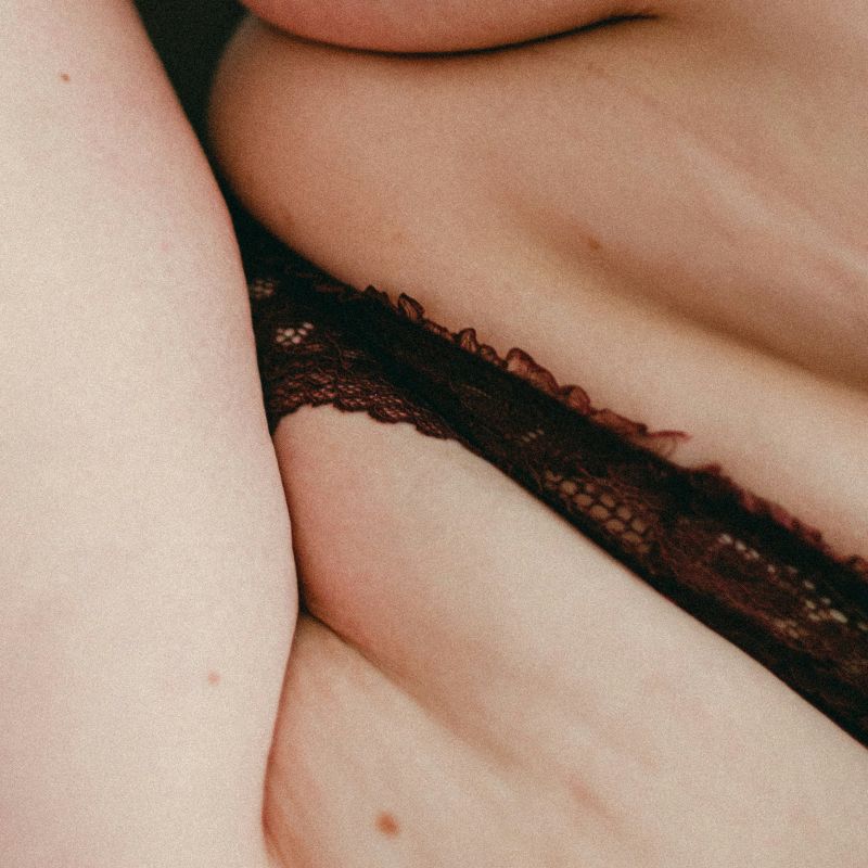 HIFU Ultherapie voor een natuurlijke verstrakking en versteviging van de huid