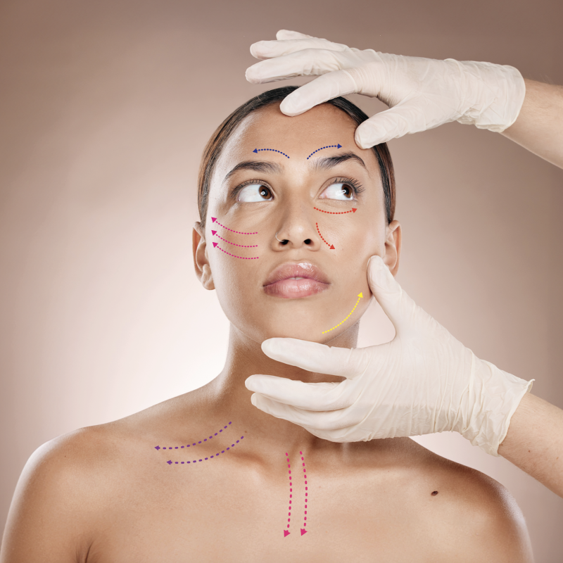 HIFU Ultherapie voor een natuurlijke verstrakking en versteviging van de huid